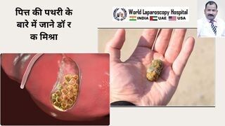 पित्ताशय की पथरी के बारे में जाने विश्व के जाने माने डॉक्टर से