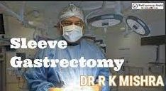 Bariatric Surgery Laparoscopic sleeve Gastrectomy Step by Step Video by Dr R K Mishra
