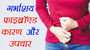 लेप्रोस्कोपिक मायोमेक्टोमी क्या है? फाइब्रॉएड गर्भाशय के लिए उपचार और कौनसा मेरे लिए सबसे अच्छा है?