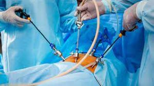 Extracorporeal Knot For Laparoscopic Appendicectomy