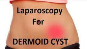 Foundation Course on Laparoscopic Cholecystectomy and Laparoscopic Hysterectomy
