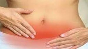 Extracorporeal Knot For Laparoscopic Appendicectomy