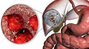 WALS 2025 Awaits: A Premier Gathering of Surgical Innovators