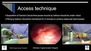 Access Techniques Access is the key of Success