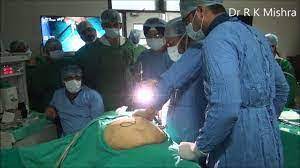 Endometriosis fulguration, ablation & Application of Interceed