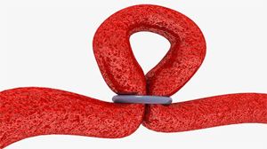 Mastering the Technique: Dr. R.K. Mishra's Demonstration of Laparoscopic Surgeon's Knot