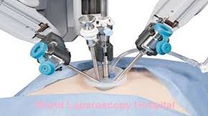 Why Laparoscopic Surgery is Better ?