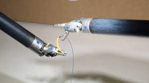 Revolutionizing PCOD Treatment: The Laparoscopic Needle Advantage