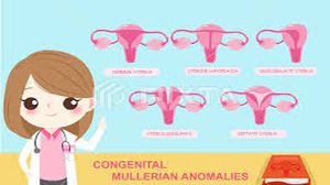 Congenital Müllerian anomalies with two cavitated, non-communicating rudimentary horn