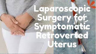 Laparoscopic Myomectomy for Large Broad ligament Fibroid