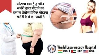 मोटापा क्या है दूरबीन सर्जरी द्वारा मोटापे का इलाज  लेप्रोस्कोपिक मोटापा सर्जरी कैसे की जाती है