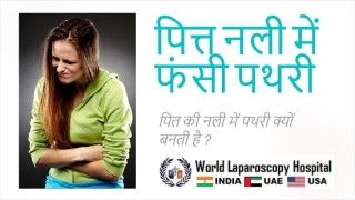 A Comprehensive Guide to Mastering Abdominal Access in Laparoscopic Surgery