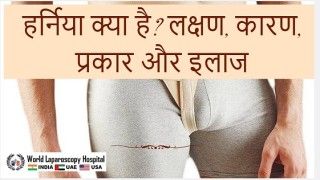 हर्निया लक्षण, कारण, प्रकार और इलाज