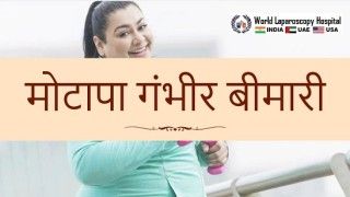 मोटापा गंभीर बीमारी, लेकिन दूरबीन विधि से ऑपरेशन संभव