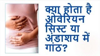 ओवेरियन सिस्ट या अंडाशय में गांठ, जानें इसके लक्षण, कारण और इलाज