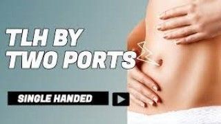 Total Laparoscopic Hysterectomy by Two 5 mm Ports - Single Instrument Surgery