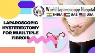 Hysterectomy for Multiple Fibroid by Laparoscopic 3 ports