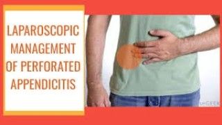 Sleeve Gastrectomy Fully Explained by Dr R K Mishra