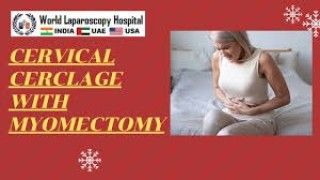Laparoscopic Surgery For Large Broad Ligament Fibroid