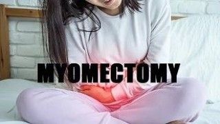 Laparoscopic Myomectomy with Baseball Suturing