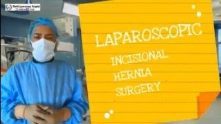 Laparoscopic Incisional Hernia Repair by IPOM Plus Technique and Titanized Mesh