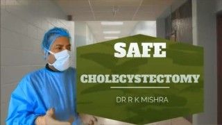 Safe Way of Performing Laparoscopic Cholecystectomy