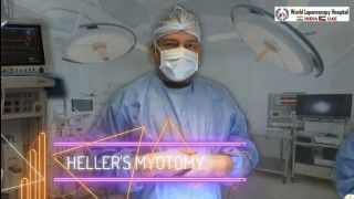 Laparoscopic Heller's Myotomy with Appendectomy