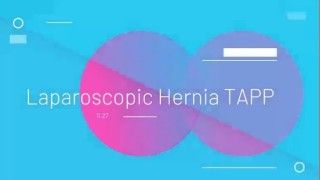 Laparoscopic Repair of Incisional Hernia