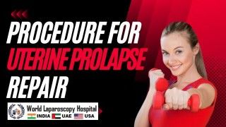 Revitalizing Quality of Life: Advanced Surgical Procedure for Uterine Prolapse Repair