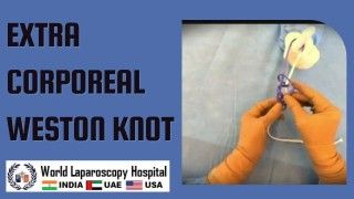 Master the Art of Extra Corporeal Weston Knot: Learn the Technique and Tips from Experts