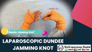 Master the Laparoscopic Dundee Jamming Knot: Learn the Technique and Tips from Experts