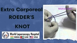 Mastering the Extra Corporeal Roeder's Knot: Advanced Knot-Tying Techniques.