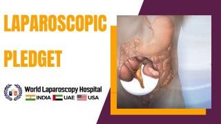 Improved Surgical Precision with Laparoscopic Pledget