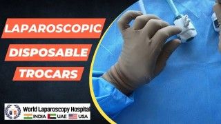 Laparoscopic Cholecystectomy High definition Video by Dr. R.K. Mishra