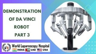 Gastric Bypass and Mini Gastric Bypass Lecture by Dr R K Mishra