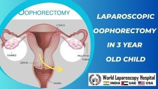 Pioneering Laparoscopic Oophorectomy in a 3-Year-Old Child
