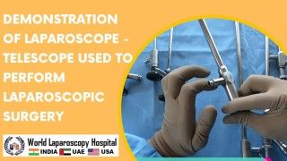 Exploring Laparoscopic Surgery: A Captivating Demonstration of the Essential Laparoscope Telescope