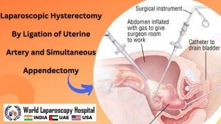 Laparoscopic Hysterectomy with Uterine Artery Ligation and Simultaneous Appendectomy