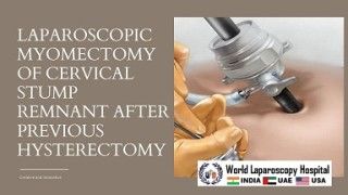 Clipless Laparoscopic Cholecystectomy