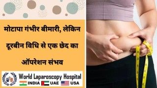 मोटापा गंभीर बीमारी, लेकिन दूरबीन विधि से एक छेद कर ऑपरेशन संभव