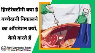 हिस्टेरेक्टॉमी: बच्चेदानी निकालने का ऑपरेशन क्या है और इसे कैसे किया जाता है?