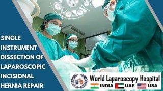 Laparoscopic Cholecystectomy with ligation of cystic duct by Dr R K Mishra