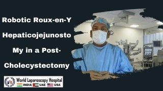 Surgical Precision Redefined: Robotic Roux-en-Y Hepaticojejunostomy for Bile Duct Injury