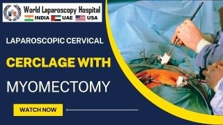 Laparoscopic Cervical Cerclage with Myomectomy Offers Minimally Invasive Solutions
