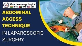 Abdominal Entry Technique in Laparoscopic Surgery