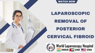 पित्त की थैली पथरी: दूरबीन से ऑपरेशन, दुष्परिणाम और इलाज के प्रमुख पहलुओं का विश्लेषण