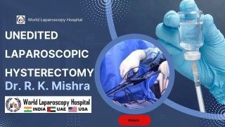 Laparoscopic Repair of Large Hiatus Hernia Lecture by Dr R K Mishra