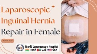 Laparoscopic Inguinal Hernia Repair: A Minimally Invasive Approach for Females