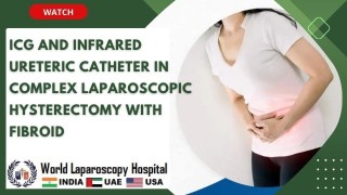 ICG and Infrared Ureteric Catheter in Challenging Total Laparoscopic Hysterectomy with Fibroid