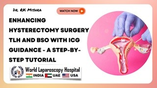 Optimizing Hysterectomy Techniques: A Detailed Guide to TLH and BSO Using ICG
